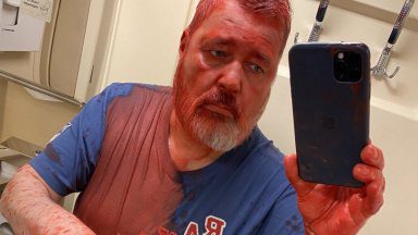 Russian Nobel Peace Prize winner was attacked with red paint