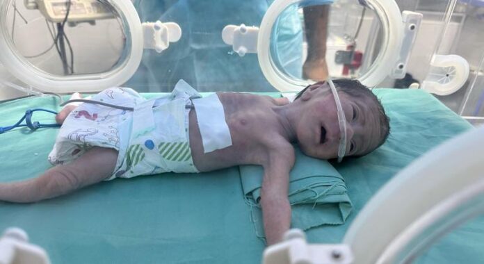 Gaza: More deaths reported as starvation spreads