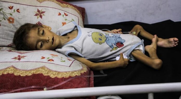 Gaza: Acute malnutrition among children hits record high