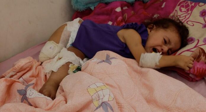 1756092303_image770x420cropped.jpg Driven by hunger in Gaza, amputees are part of the collateral damage