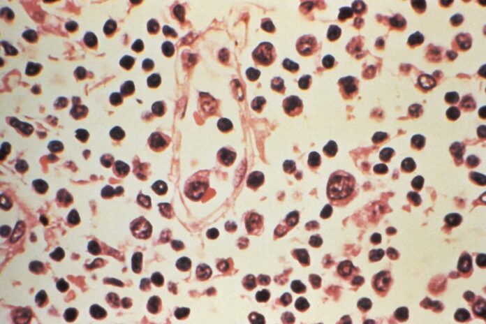 Hantavirus-from-the-Andres-strain-to-the-lethality-rate-the.jpg