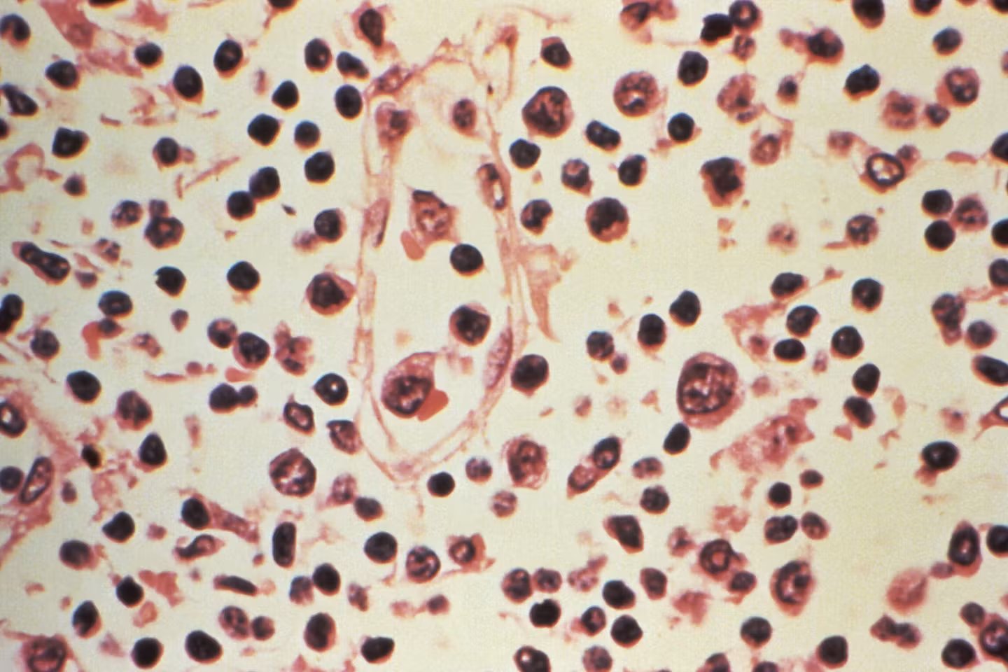 Hantavirus: from the Andres strain to the lethality rate, the lexicon to understand the words that circulate with this virus