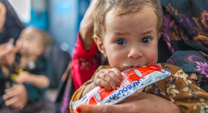Afghanistan: 3.7 million young lives at risk of malnutrition, UNICEF warns